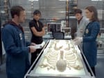 The Bones Team