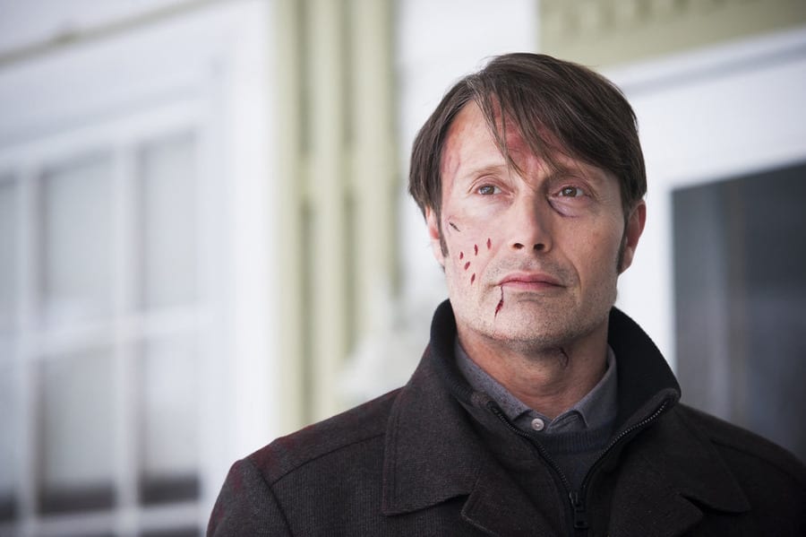 Hannibal Season 3 Episode 7 Review Digestivo TV Fanatic