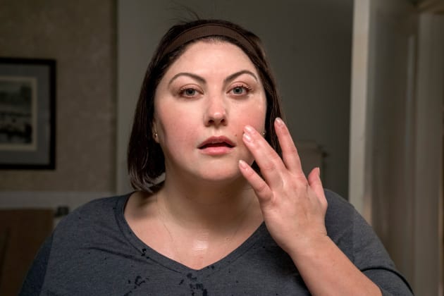 Beauty Treatment - Dietland Season 1 Episode 4