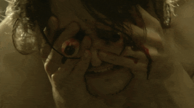 Werewolf Transformation - Hemlock Grove