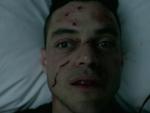 Elliot in Pain - Mr. Robot Season 2 Episode 6