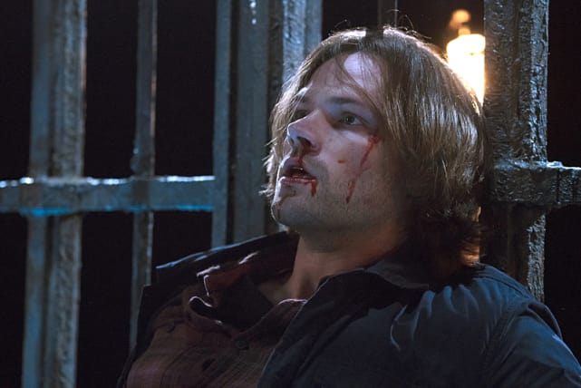 Bloody and beaten - Supernatural Season 11 Episode 10