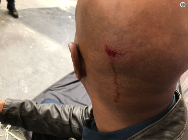 The Injury