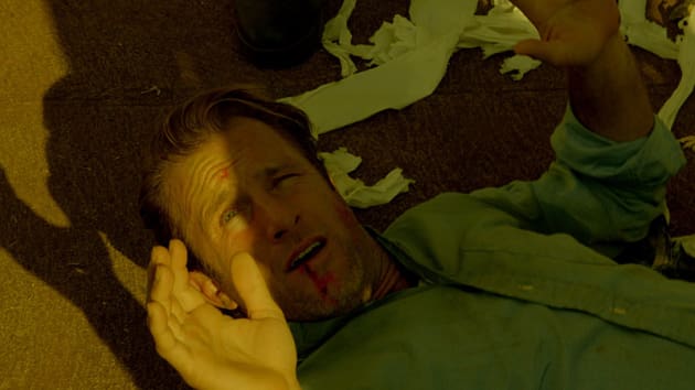 Danny Bloody - Hawaii Five-0 Season 5 Episode 18