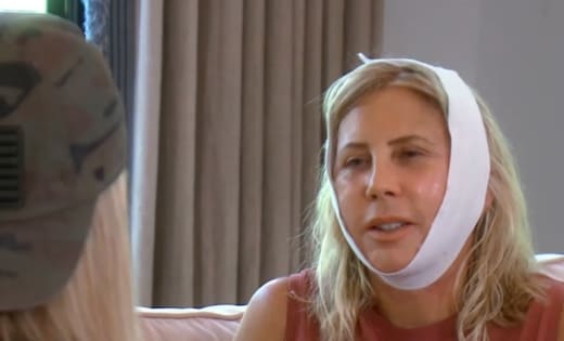 After The Procedure - The Real Housewives of Orange County