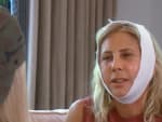 After The Procedure - The Real Housewives of Orange County