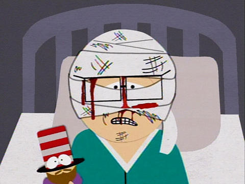 Tom's Rhinoplasty Picture