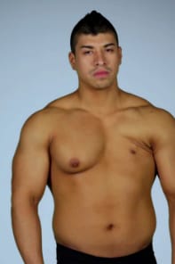 Botched season 2 hot sale episode 10 full episode