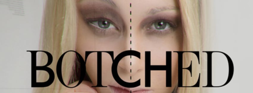 Botched full episodes online clearance