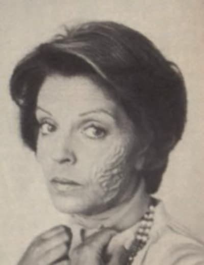 Julie Gets Burned - Days of Our Lives